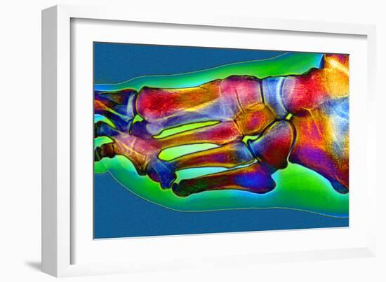 Normal Foot, X-ray-Du Cane Medical-Framed Photographic Print