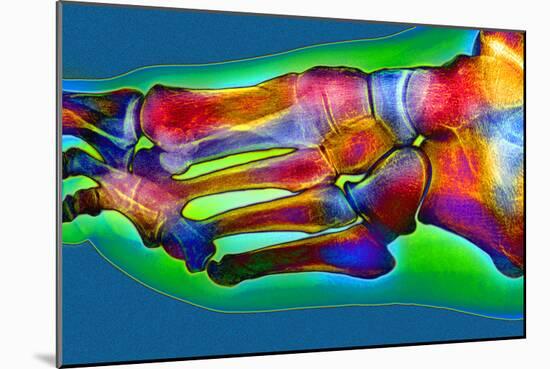 Normal Foot, X-ray-Du Cane Medical-Mounted Photographic Print