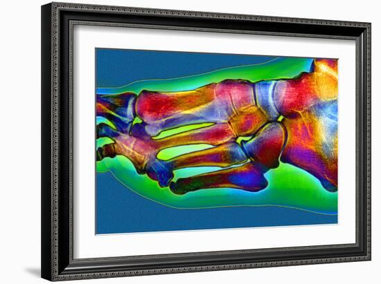 Normal Foot, X-ray-Du Cane Medical-Framed Photographic Print