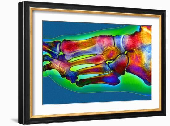 Normal Foot, X-ray-Du Cane Medical-Framed Photographic Print