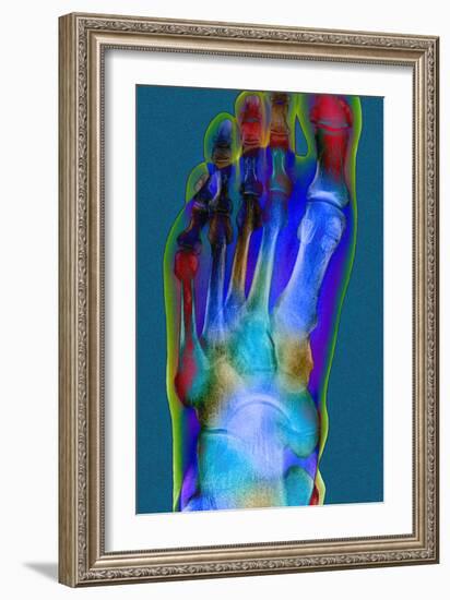 Normal Foot, X-ray-Du Cane Medical-Framed Photographic Print