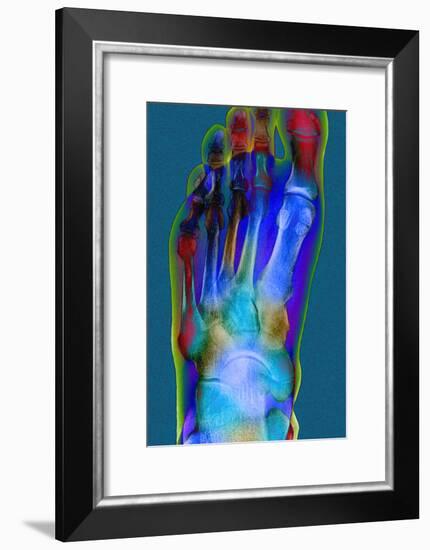 Normal Foot, X-ray-Du Cane Medical-Framed Photographic Print