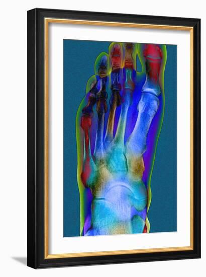 Normal Foot, X-ray-Du Cane Medical-Framed Photographic Print