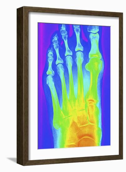 Normal Left Foot, X-ray-PASIEKA-Framed Photographic Print