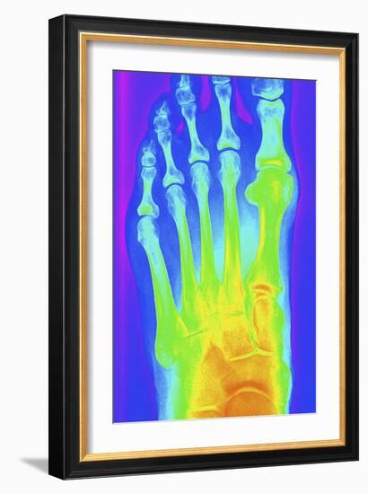 Normal Left Foot, X-ray-PASIEKA-Framed Photographic Print