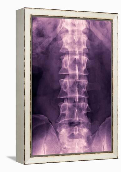 Normal Lumbar Spine, X-ray-Miriam Maslo-Framed Premier Image Canvas