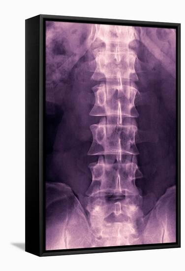 Normal Lumbar Spine, X-ray-Miriam Maslo-Framed Premier Image Canvas