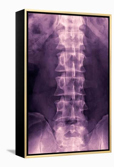 Normal Lumbar Spine, X-ray-Miriam Maslo-Framed Premier Image Canvas