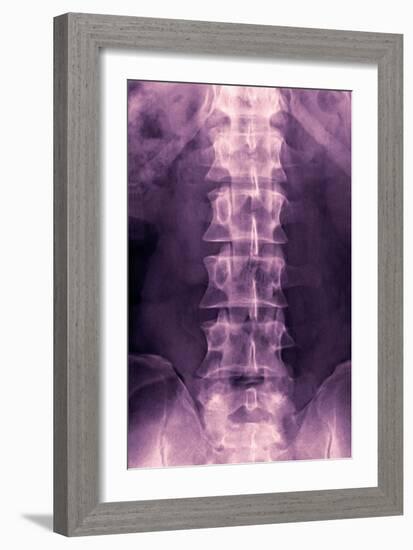 Normal Lumbar Spine, X-ray-Miriam Maslo-Framed Photographic Print