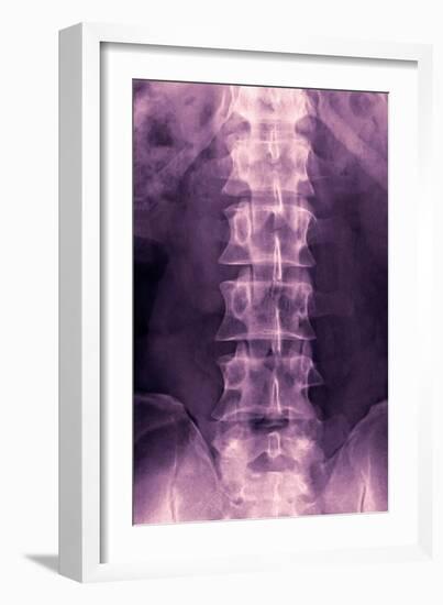 Normal Lumbar Spine, X-ray-Miriam Maslo-Framed Photographic Print