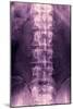 Normal Lumbar Spine, X-ray-Miriam Maslo-Mounted Photographic Print