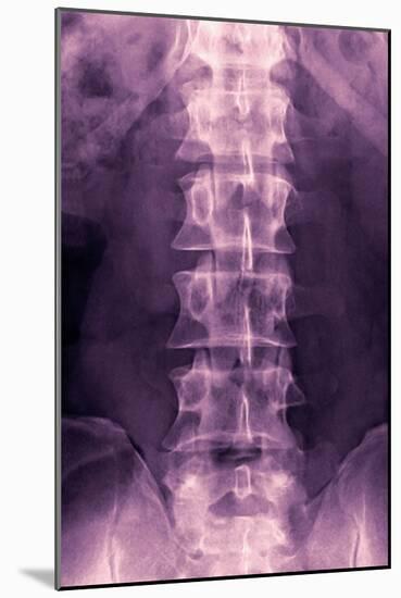 Normal Lumbar Spine, X-ray-Miriam Maslo-Mounted Photographic Print