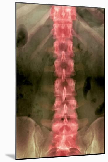 Normal Lumbar Spine, X-ray-Du Cane Medical-Mounted Photographic Print