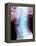 Normal Neck, X-ray-Du Cane Medical-Framed Premier Image Canvas