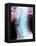 Normal Neck, X-ray-Du Cane Medical-Framed Premier Image Canvas