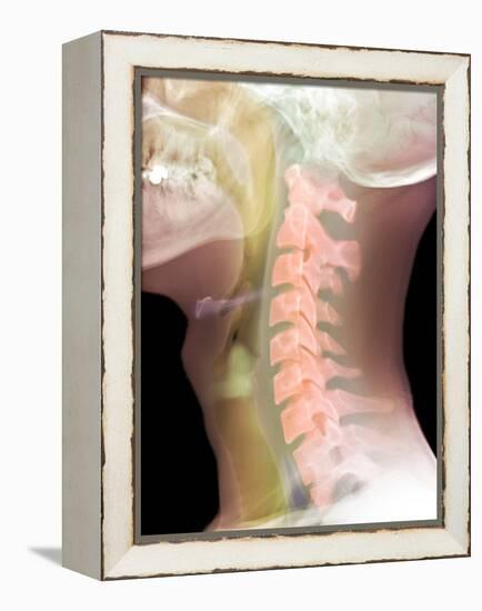 Normal Neck, X-ray-Du Cane Medical-Framed Premier Image Canvas