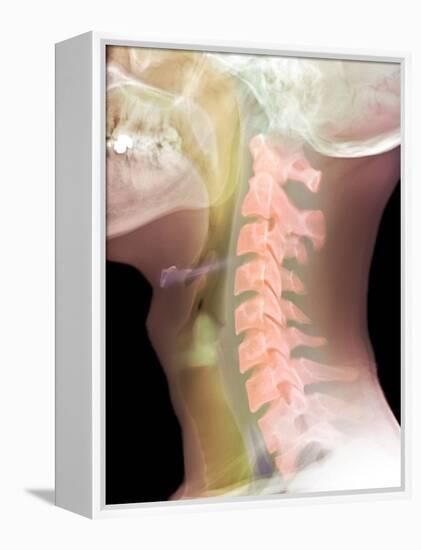 Normal Neck, X-ray-Du Cane Medical-Framed Premier Image Canvas