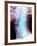 Normal Neck, X-ray-Du Cane Medical-Framed Photographic Print