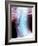 Normal Neck, X-ray-Du Cane Medical-Framed Photographic Print