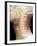 Normal Neck, X-ray-Du Cane Medical-Framed Photographic Print