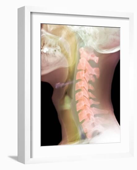 Normal Neck, X-ray-Du Cane Medical-Framed Photographic Print