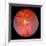 Normal Retina of Eye-Rory McClenaghan-Framed Photographic Print