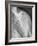 Normal Shoulder, X-ray-ZEPHYR-Framed Photographic Print