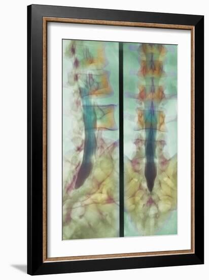 Normal Spinal Cord, X-ray-Science Photo Library-Framed Photographic Print