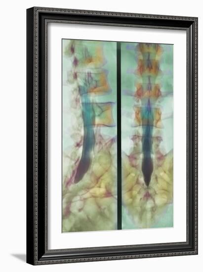 Normal Spinal Cord, X-ray-Science Photo Library-Framed Photographic Print