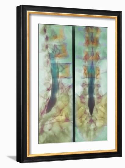 Normal Spinal Cord, X-ray-Science Photo Library-Framed Photographic Print