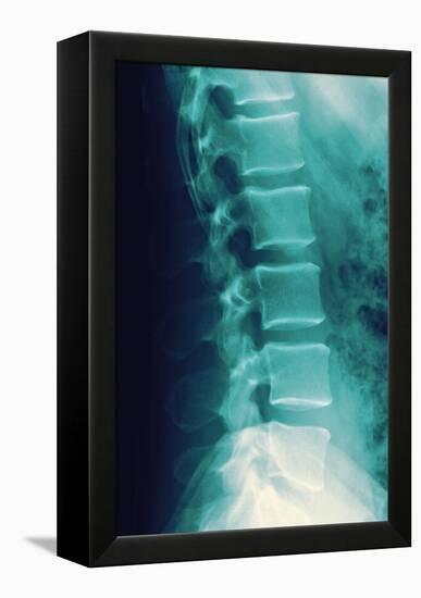 Normal Spine, X-ray-Miriam Maslo-Framed Premier Image Canvas