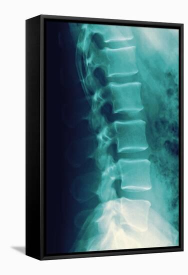 Normal Spine, X-ray-Miriam Maslo-Framed Premier Image Canvas