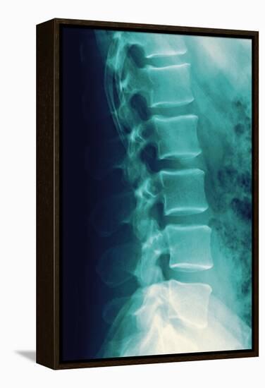 Normal Spine, X-ray-Miriam Maslo-Framed Premier Image Canvas
