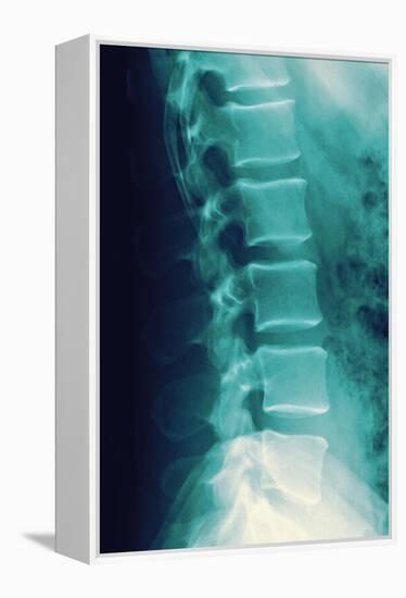 Normal Spine, X-ray-Miriam Maslo-Framed Premier Image Canvas