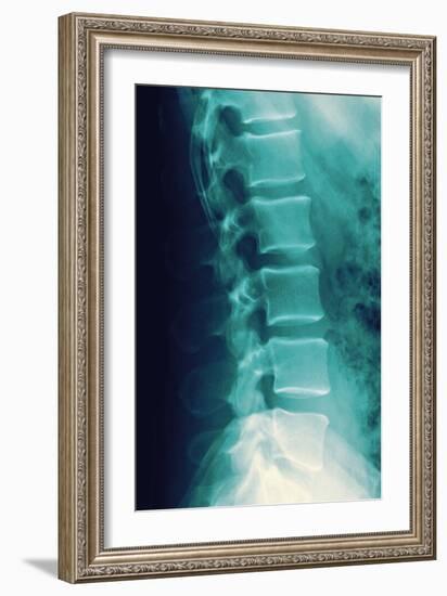 Normal Spine, X-ray-Miriam Maslo-Framed Photographic Print