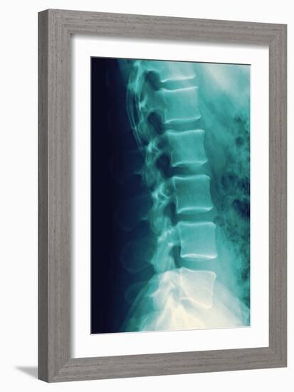 Normal Spine, X-ray-Miriam Maslo-Framed Photographic Print