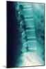 Normal Spine, X-ray-Miriam Maslo-Mounted Photographic Print