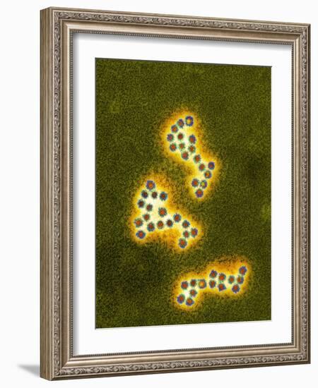 Norovirus Particles, TEM-Infections Centre-Framed Photographic Print