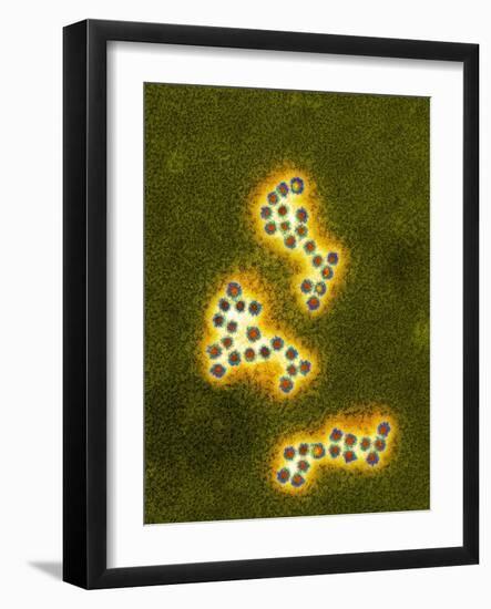 Norovirus Particles, TEM-Infections Centre-Framed Photographic Print