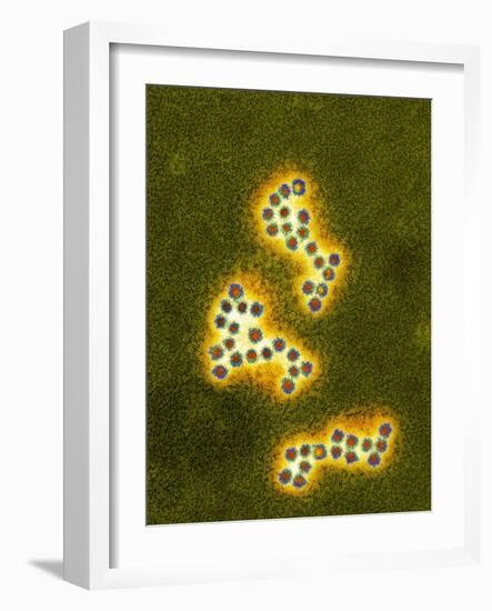 Norovirus Particles, TEM-Infections Centre-Framed Photographic Print