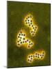 Norovirus Particles, TEM-Infections Centre-Mounted Photographic Print