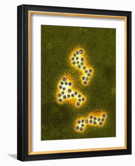 Norovirus Particles, TEM-Infections Centre-Framed Photographic Print