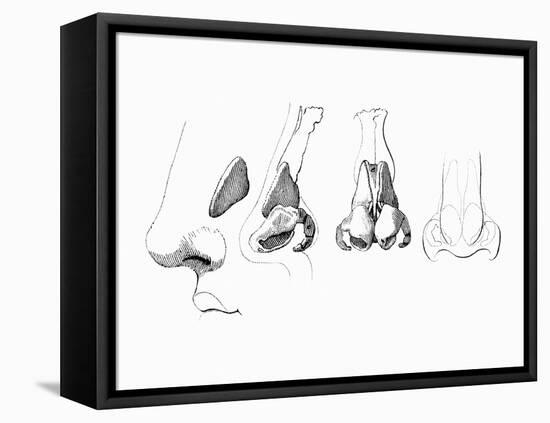 Noses-Mehau Kulyk-Framed Premier Image Canvas