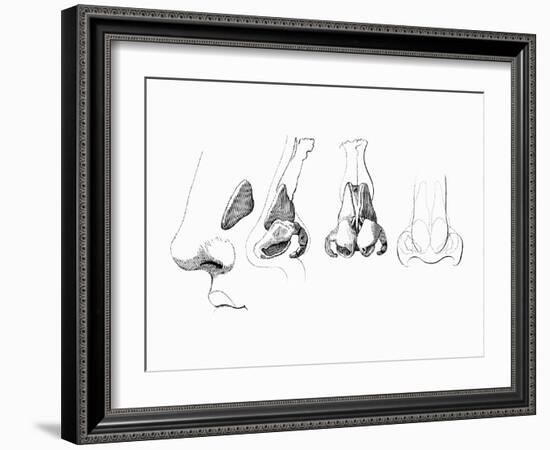 Noses-Mehau Kulyk-Framed Photographic Print