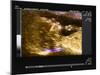 Nuchal Scan for Down's Syndrome-Science Photo Library-Mounted Photographic Print
