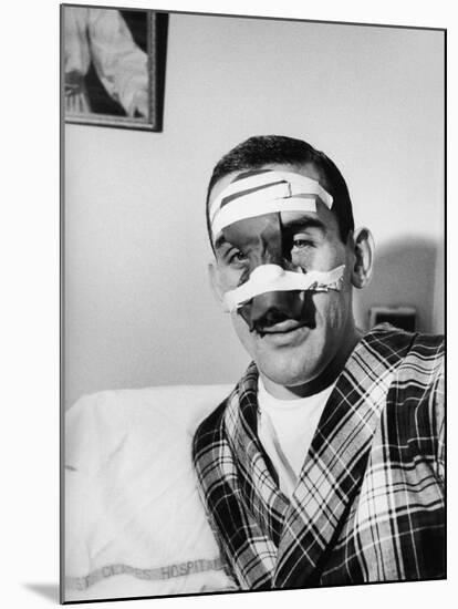 Ny Rangers Player Lou Fontinato Showing His Broken Nose Which He Received During a Game-null-Mounted Premium Photographic Print