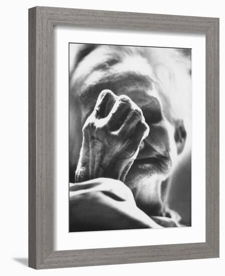 Old Woman Patient at the St. Louis Chronic Hospital-Grey Villet-Framed Photographic Print