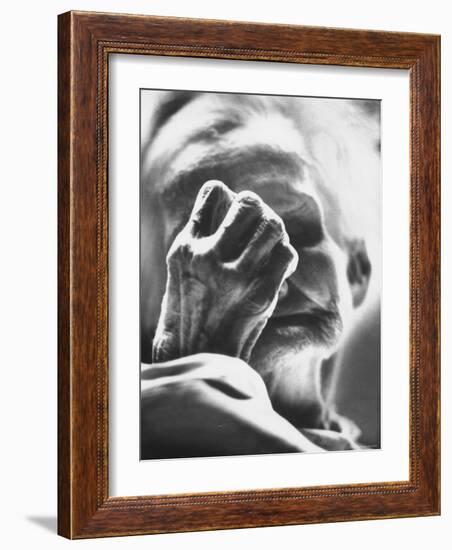 Old Woman Patient at the St. Louis Chronic Hospital-Grey Villet-Framed Photographic Print