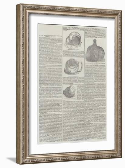 On Some Remarkable Examples of Irregular Growth in the Oyster-null-Framed Giclee Print