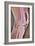 Osteoarthritic Knee X-ray-null-Framed Photographic Print